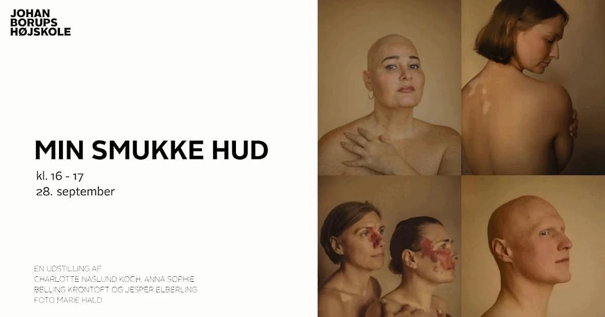 Finisage: Min smukke hud